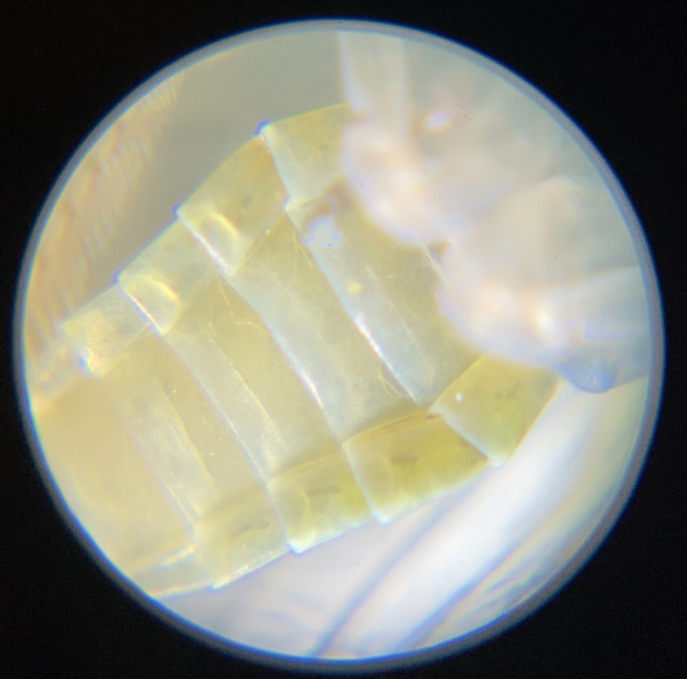 Nahaufnahme eines Petrischälchens mit einem kleinen Lebensmittelstück und einem sichtbaren Mikroorganismus vor dunklem Hintergrund.