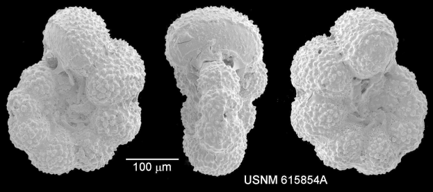 Schwarzes und weißes Mikroskopbild von drei verschiedenen Krebszelltypen auf einem dunklen Hintergrund mit dem Text "USNM 615854A" unten.